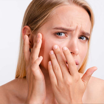 Building Trust Through Understanding: Skin Purging versus Breakouts