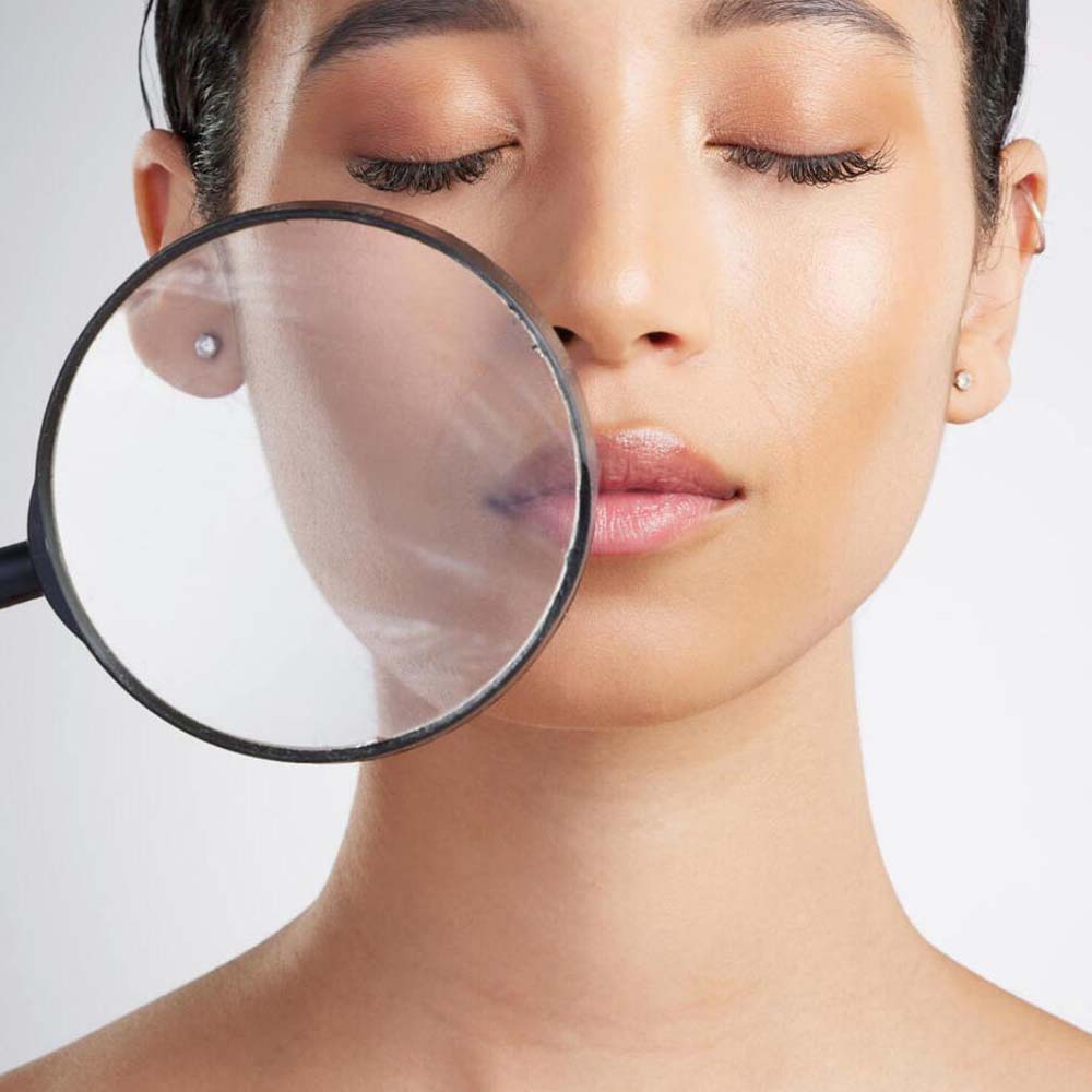 A girl with oily skin and a red spot on her face, showcasing the challenges of skincare.