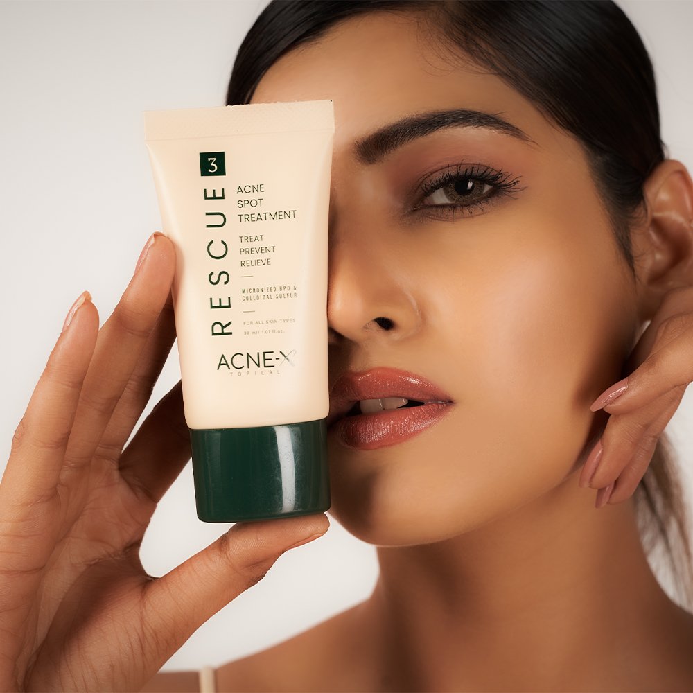 A Candid Look at Rescuing: Acne-X Topical’s Step 3 Rescue, Your Ultimate Acne Spot Treatment - Acne-X Topical