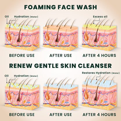 RENEW: Gentle Skin Cleanser